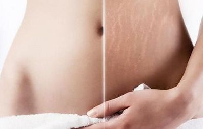 浙江知名隆胸醫(yī)院推薦！這些醫(yī)院廣受好評