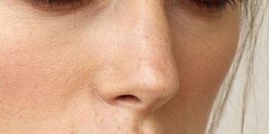 2023年鄭州有哪些受歡迎的植發(fā)醫(yī)院？醫(yī)美行業(yè)走向解析