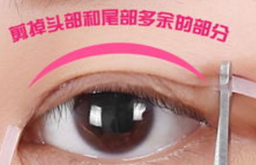 樂山市人民醫(yī)院眼袋手術(shù)口碑如何？醫(yī)生推薦+真實(shí)案例分析