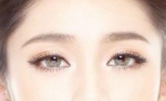 石家莊美聯(lián)臣雙眼皮整形靠譜嗎？有哪些優(yōu)秀醫(yī)生？有什么成功案例供參考？