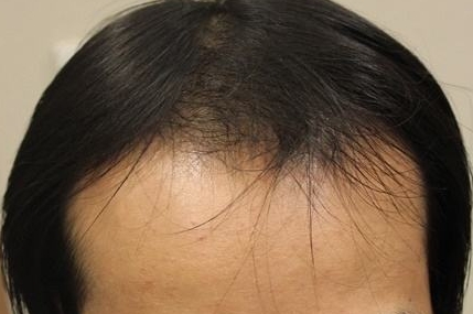 徐州市中心醫(yī)院整形美容科技術(shù)如何？周同葵主任能否提供擅長項目信息？