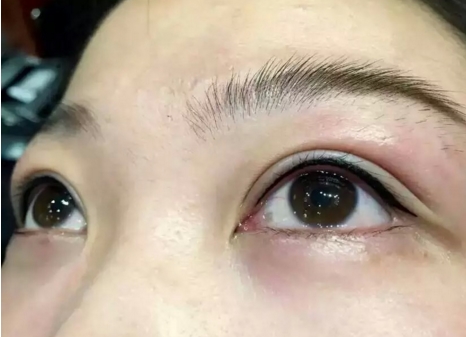 長(zhǎng)沙愛(ài)思特整形醫(yī)院口碑如何？全新隆胸恢復(fù)過(guò)程親體驗(yàn)到底值不值得參考？