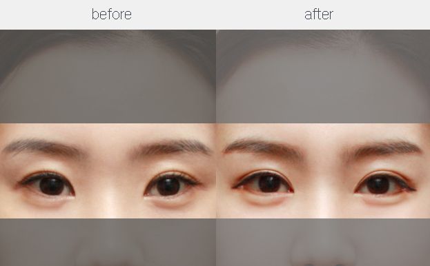 【特約】重慶鼻整形手術修復醫(yī)生五強名單揭曉，專家推薦！