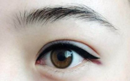 南寧醫(yī)科大雙眼皮整形費用及技術綜述！名單與收費指南分享