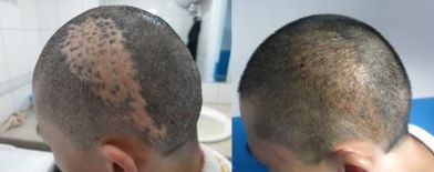 杭州有哪些專業(yè)技術(shù)過硬的鼻修復(fù)醫(yī)院？推薦浙江第二醫(yī)院、薇琳整形醫(yī)院、清鍇醫(yī)療美容中心等