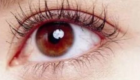 經驗豐富的專業(yè)修復師鄭永生，展示雙眼皮修復案例