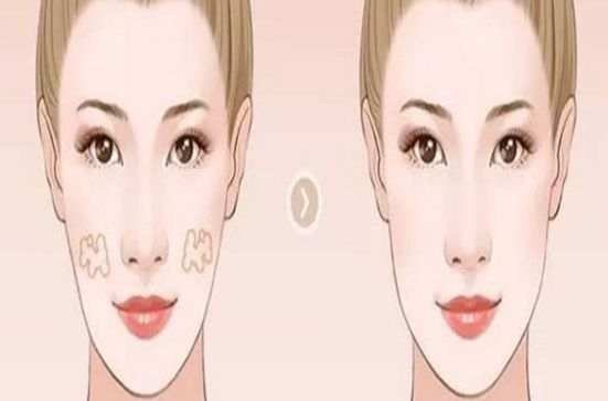 鄭州專業(yè)隆鼻醫(yī)生推薦！這幾位技術(shù)嫻熟，信譽(yù)口碑不容錯(cuò)過