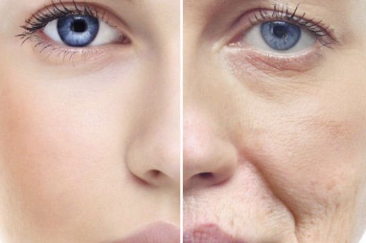 哈醫(yī)大一院陳偉華醫(yī)生成功修復(fù)雙眼皮的治療方式揭秘，2023實例公開！