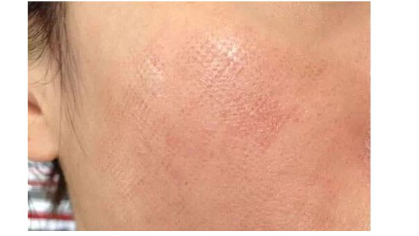 貴陽豐鼻醫(yī)生推薦TOP7專家候選已鎖定，屆時欽點！