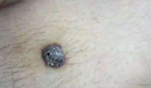 佛山醫(yī)生榜單：受人推崇的業(yè)界認(rèn)可名單曝光