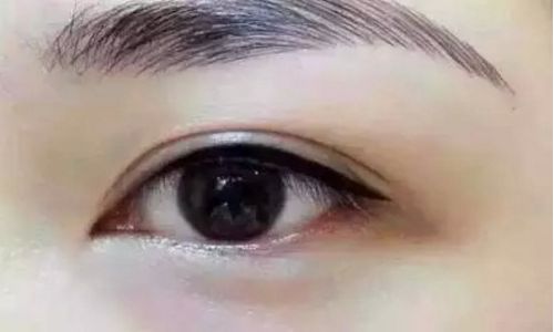 懿恩醫(yī)療美容的吸脂案例最新發(fā)布，效果驚艷，你不容錯過！