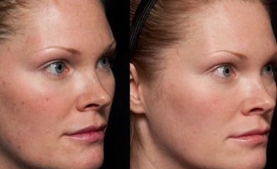 2023年南京磨骨醫(yī)生排行榜！這5位專家大咖讓您眼前一亮！