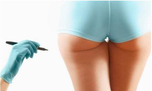 專業(yè)的拉皮整形醫(yī)生們，技術(shù)實(shí)力大咖！不同醫(yī)生各顯優(yōu)勢(shì)