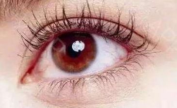 浙江醫(yī)院范希玲雙眼皮手術(shù)費(fèi)用2023年新浮現(xiàn)，消費(fèi)者案例分享