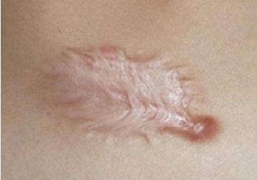 天津市最受歡迎的雙眼皮整形醫(yī)院排行榜發(fā)布，熱度爆表！