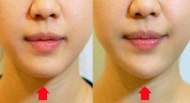 重磅發(fā)布！南京五家面部吸脂醫(yī)院排行盛況揭曉！