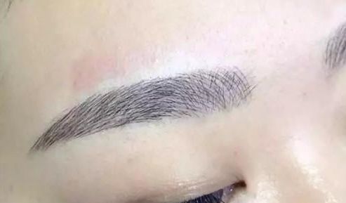 昆明祛斑哪家醫(yī)院更受歡迎？大眾口碑告訴你答案！