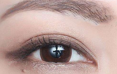 林琳雙眼皮修復(fù)失敗案例分享，術(shù)后視野恢復(fù)亮眼！