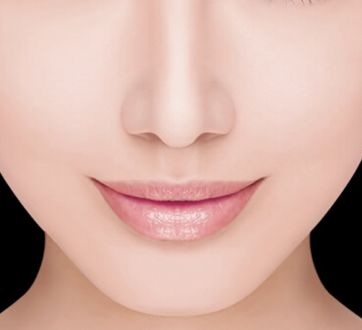 哈醫(yī)大四院李巍主治醫(yī)生鼻整形手術！80天重塑完美鼻型全記錄！