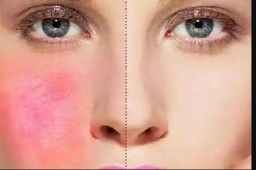 榆林雙眼皮修復(fù)誰(shuí)的技術(shù)更值得信賴？