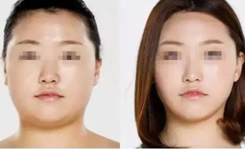 寧波2023年抽脂醫(yī)生排名揭曉！這幾位口碑爆棚的專家堪稱翹楚！