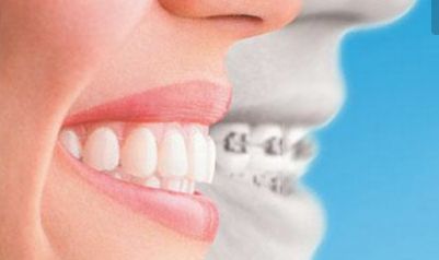 賀煥煥做雙眼皮修美，醫(yī)生簡介及2023價格明細(xì)公布！