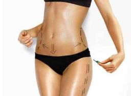 齊魯醫(yī)院大腿抽脂案例分享：專家解析、費(fèi)用說明、效果好嗎