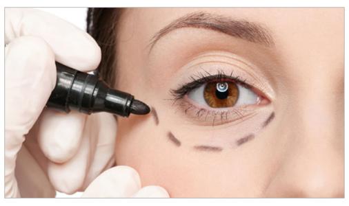 濟(jì)南中心醫(yī)院整形科靠譜嗎？有哪些雙眼皮價(jià)格與案例值得一看？