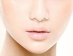 整形技術首席專家白明，美麗改造雙眼皮效果如何？案例分析大揭秘！