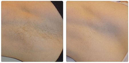 上海德琳醫(yī)療美容醫(yī)院整形價格貴嗎？王藎醫(yī)生有提供服務(wù)嗎？