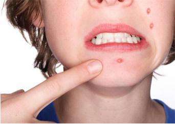 貴陽有哪些專業(yè)的自體脂肪豐蘋果肌整形美容醫(yī)院？前8家有哪些？可查詢價格！