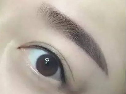 護(hù)眼實(shí)踐：林琦東如何改善視力？真實(shí)案例揭示眼部整形費(fèi)用