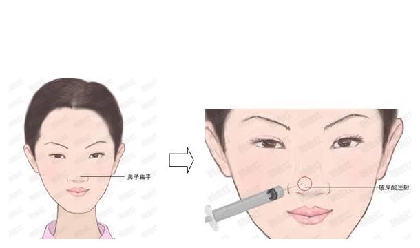 河南省整形醫(yī)院推薦：華領(lǐng)、維多利亞與締萊美大放異彩！