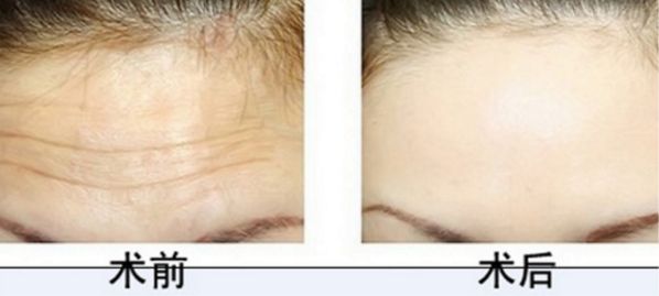 廣州正頜手術(shù)醫(yī)院排行榜：權(quán)威專家推薦，火爆熱門醫(yī)院解析