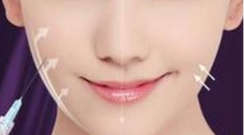 協(xié)和美容整形醫(yī)院的醫(yī)生團隊與假體隆鼻案例智造完美鼻形