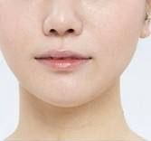 國內(nèi)哪些醫(yī)院在頜面整形方面做得更好？優(yōu)質(zhì)正頜手術(shù)醫(yī)院推薦