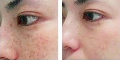 成都整形醫(yī)院排行揭曉！驚喜實(shí)力醫(yī)院都榜上有名