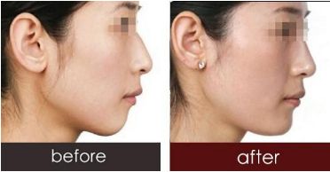 深圳哪些醫(yī)生已獲得2023年喬雅登認(rèn)證？全新名單發(fā)布！