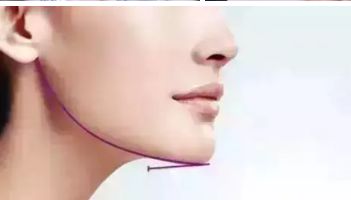 長(zhǎng)沙愛思特整形醫(yī)院：正規(guī)可信賴，服務(wù)周到！