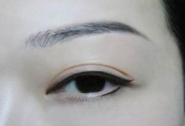 深圳著名眼袋整形專家?guī)湍獯?，鵬程醫(yī)院是否值得選擇？