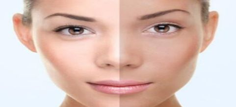 蘇薇潔成為上海九院眼部修復(fù)專家，病患們紛紛贊嘆！