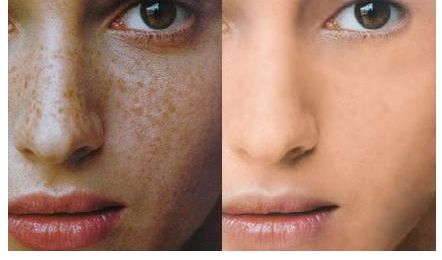 成都維度整形醫(yī)生技術(shù)點(diǎn)贊！實(shí)例曝光，周維做鼻子效果驚艷！