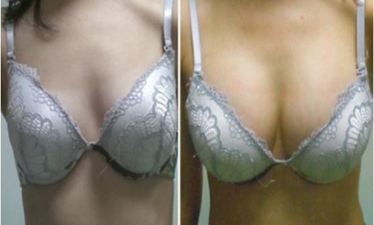 成都雙眼皮整形醫(yī)院哪家好？專家推薦的排行榜前十強