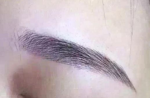 長沙脂肪吸取專家揭秘：技術卓越，無數(shù)口碑背后的醫(yī)美奇跡！