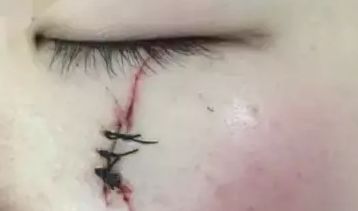 南京智美顏：了解2023吸脂案例曝光，發(fā)現(xiàn)醫(yī)療美容的驚人效果！