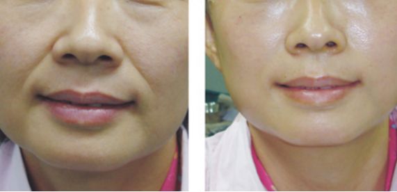 中國(guó)最值得信賴(lài)的整形醫(yī)院排行榜公開(kāi)！公立與私立醫(yī)院強(qiáng)強(qiáng)對(duì)決