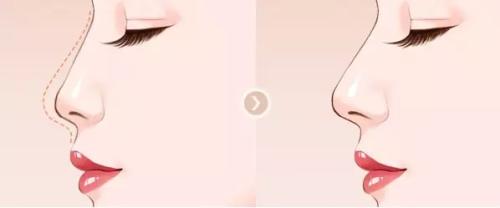 寧波韓美整形吸脂值得信賴嗎？