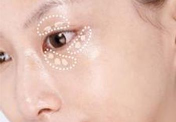 吳毅平醫(yī)生坐診醫(yī)院及隆胸案例分享，詳細介紹！