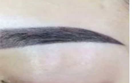 深圳哪家醫(yī)院的面部除皺效果出眾？透露美萊、鵬程、藝星等實(shí)力醫(yī)院排行榜