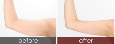 上海藝星醫(yī)療美容的口碑如何？醫(yī)術(shù)是否值得信賴？哪位醫(yī)生水平較高？